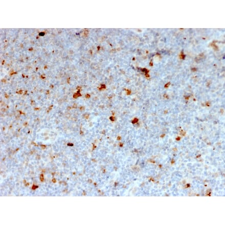 Immunohistochemistry - Anti-CD134 Antibody [OX40/2721] - BSA and Azide free (A253409) - Antibodies.com