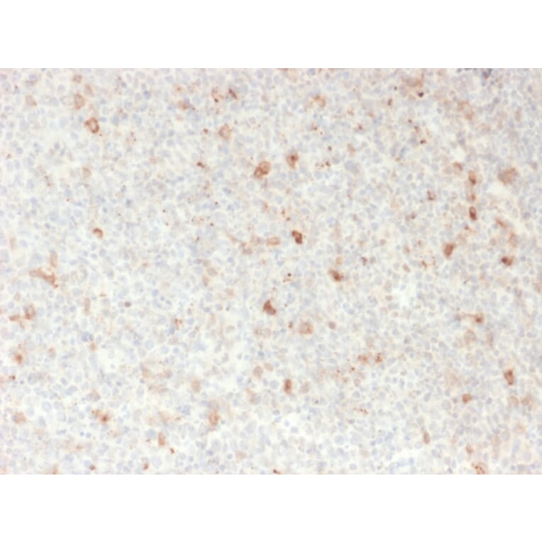 Immunohistochemistry - Anti-CD134 Antibody [OX40/2721] - BSA and Azide free (A253409) - Antibodies.com
