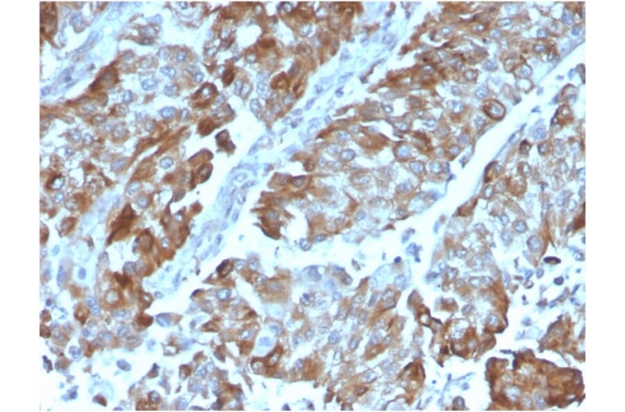 Immunohistochemistry - Anti-CD134 Antibody [OX40/3108] - BSA and Azide free (A253410) - Antibodies.com