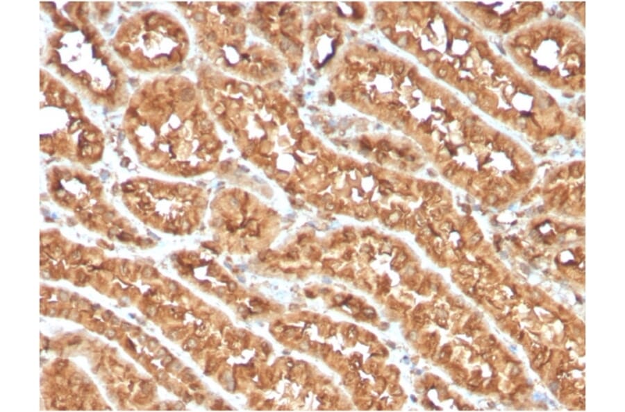 Immunohistochemistry - Anti-CD134 Antibody [OX40/3108] - BSA and Azide free (A253410) - Antibodies.com