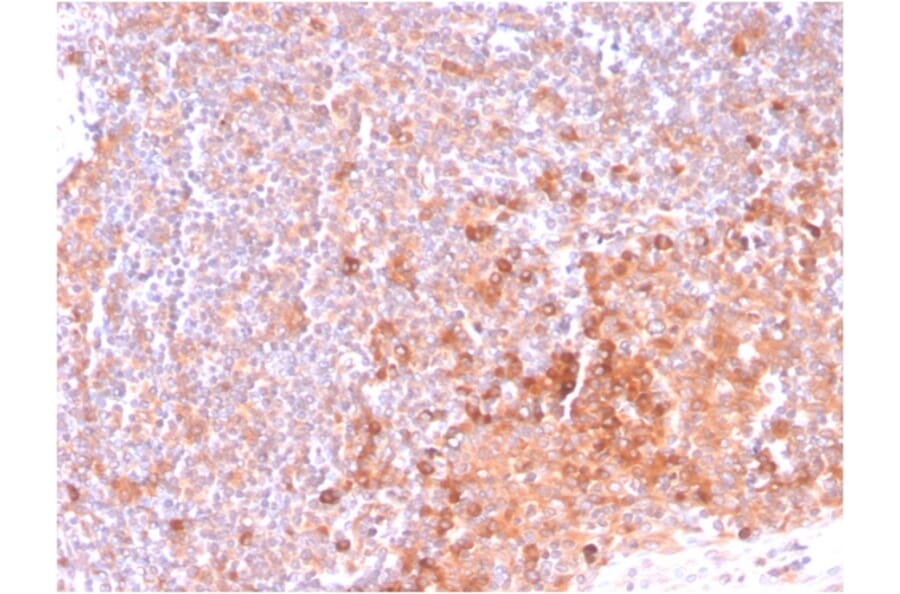 Immunohistochemistry - Anti-CD134 Antibody [OX40/3108] - BSA and Azide free (A253410) - Antibodies.com