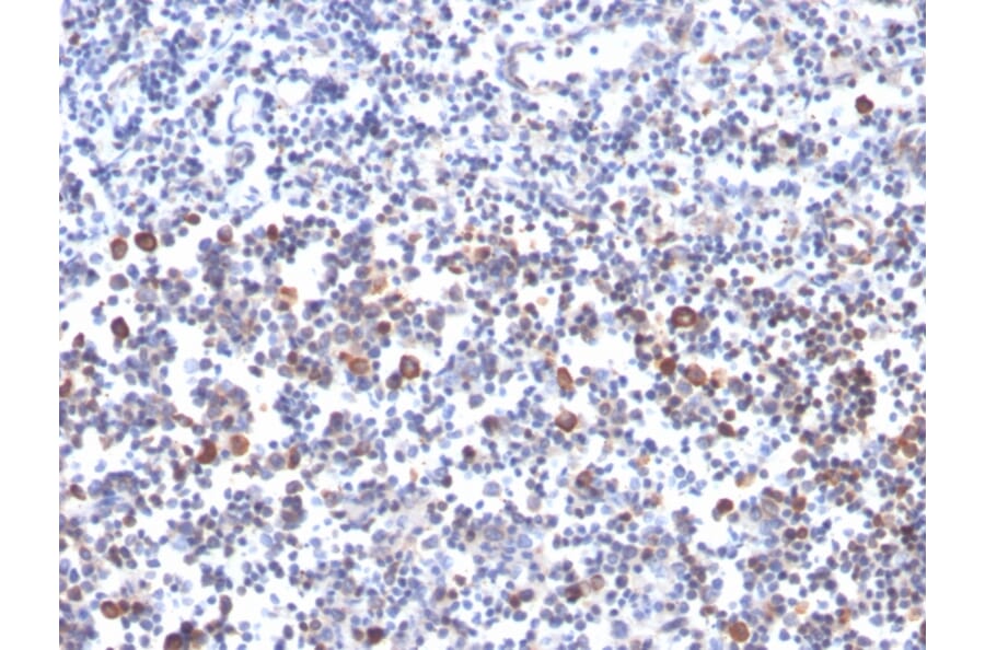 Immunohistochemistry - Anti-CD134 Antibody [OX40/3427] - BSA and Azide free (A253411) - Antibodies.com