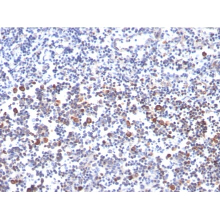 Immunohistochemistry - Anti-CD134 Antibody [OX40/3427] - BSA and Azide free (A253411) - Antibodies.com