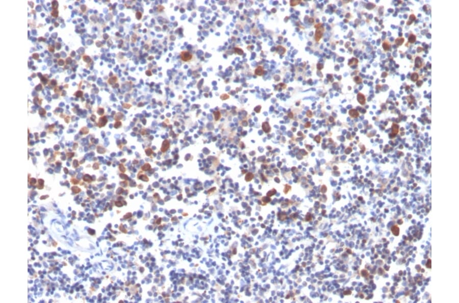 Immunohistochemistry - Anti-CD134 Antibody [OX40/3427] - BSA and Azide free (A253411) - Antibodies.com