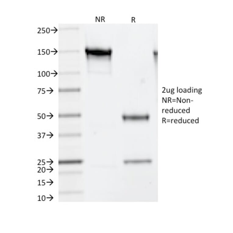 SDS-PAGE - Anti-Thymidylate Synthase Antibody [TS106] - BSA and Azide free (A253413) - Antibodies.com