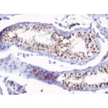 Immunohistochemistry - Anti-Thymidylate Synthase Antibody [SPM453] - BSA and Azide free (A253413) - Antibodies.com