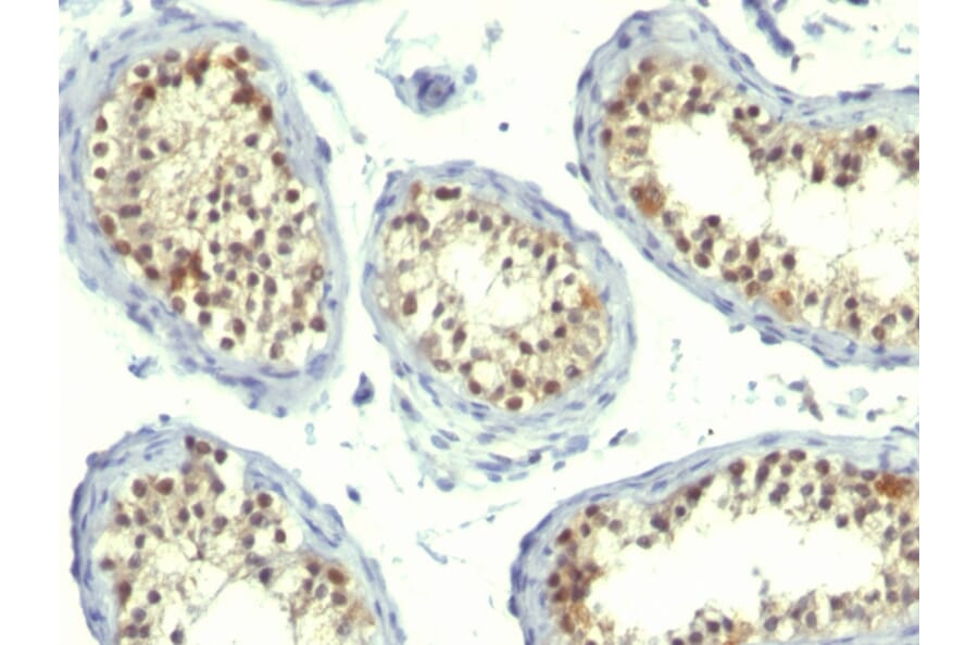 Immunohistochemistry - Anti-Thymidylate Synthase Antibody [TS106 + TMS715] - BSA and Azide free (A253415) - Antibodies.com