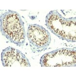 Immunohistochemistry - Anti-Thymidylate Synthase Antibody [TS106 + TMS715] - BSA and Azide free (A253415) - Antibodies.com