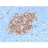 Immunohistochemistry - Anti-Thymidylate Synthase Antibody [TYMS/1884] - BSA and Azide free (A253417) - Antibodies.com