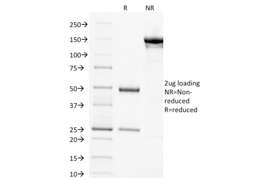 SDS-PAGE - Anti-Thymidylate Synthase Antibody [TYMS/1884] - BSA and Azide free (A253417) - Antibodies.com