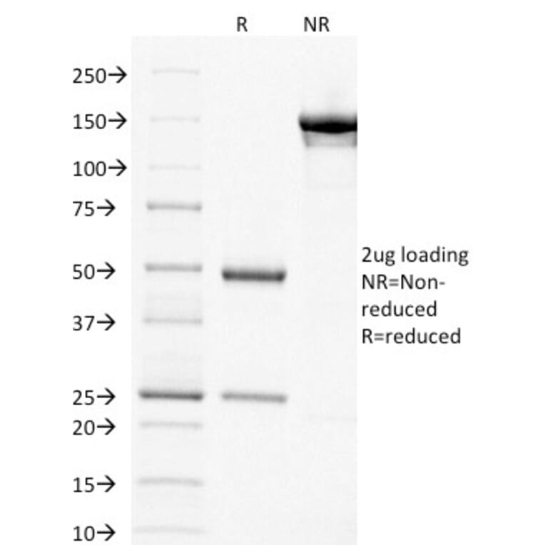 SDS-PAGE - Anti-Thymidylate Synthase Antibody [TYMS/1884] - BSA and Azide free (A253417) - Antibodies.com