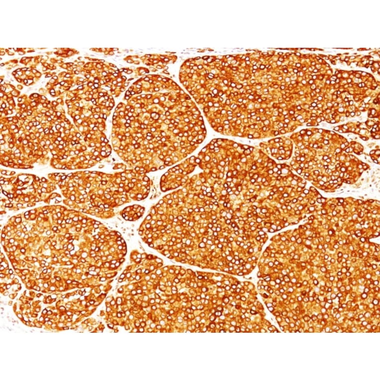 Immunohistochemistry - Anti-Tyrosinase Antibody [T311] - BSA and Azide free (A253419) - Antibodies.com