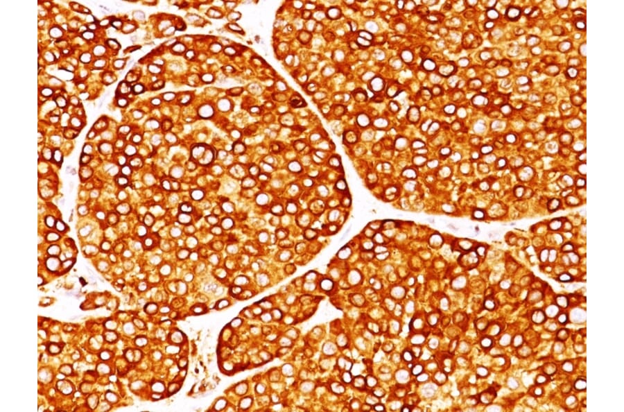 Immunohistochemistry - Anti-Tyrosinase Antibody [T311] - BSA and Azide free (A253418) - Antibodies.com