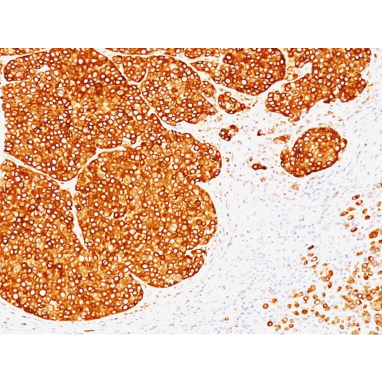 Immunohistochemistry - Anti-Tyrosinase Antibody [SPM360] - BSA and Azide free (A253419) - Antibodies.com