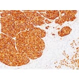 Immunohistochemistry - Anti-Tyrosinase Antibody [SPM360] - BSA and Azide free (A253419) - Antibodies.com