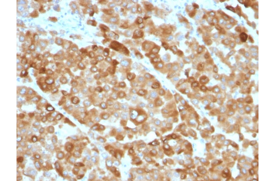 Immunohistochemistry - Anti-Tyrosinase Antibody [OCA1/812] - BSA and Azide free (A253420) - Antibodies.com