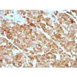 Immunohistochemistry - Anti-Tyrosinase Antibody [OCA1/812] - BSA and Azide free (A253420) - Antibodies.com