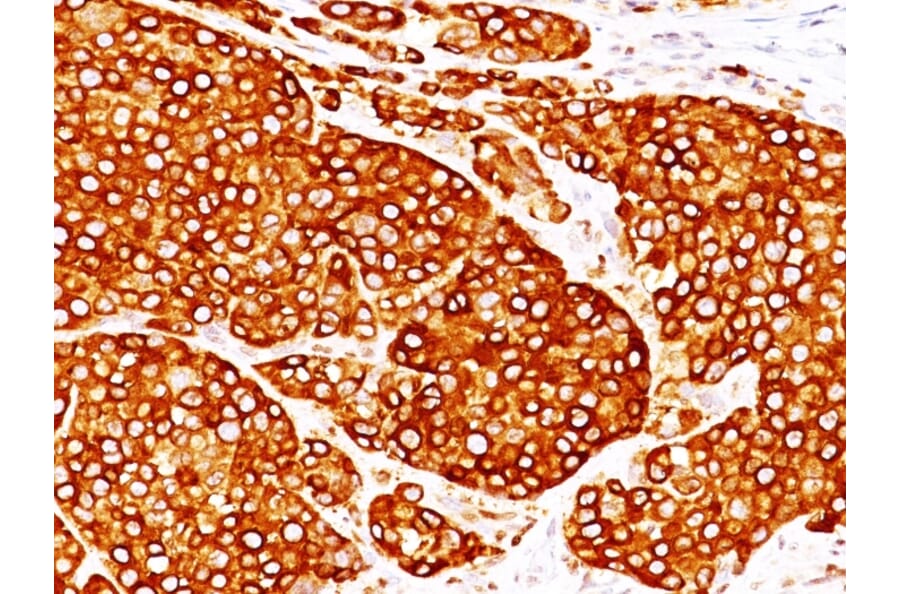 Immunohistochemistry - Anti-Tyrosinase Antibody [T311 + OCA1/812] - BSA and Azide free (A253422) - Antibodies.com