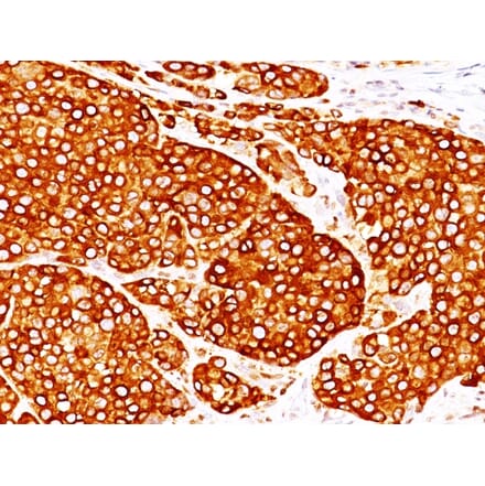 Immunohistochemistry - Anti-Tyrosinase Antibody [T311 + OCA1/812] - BSA and Azide free (A253422) - Antibodies.com
