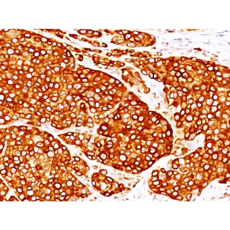 Immunohistochemistry - Anti-Tyrosinase Antibody [T311 + OCA1/812] - BSA and Azide free (A253422) - Antibodies.com