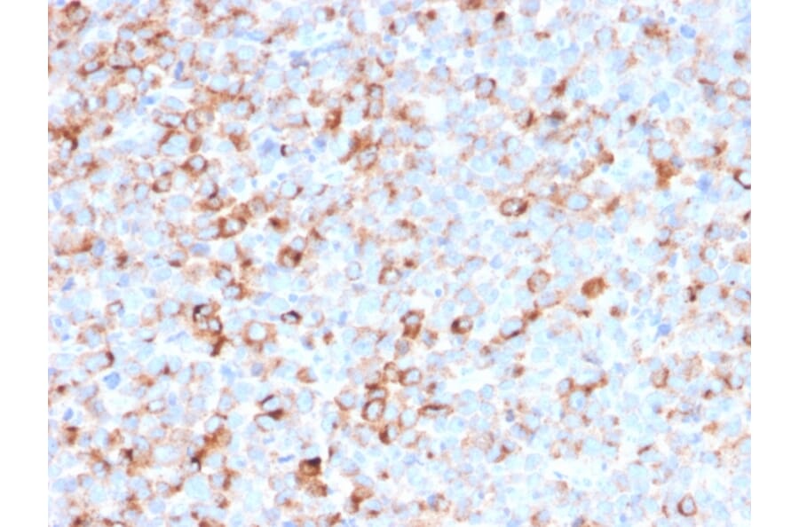 Immunohistochemistry - Anti-Tyrosinase Antibody [T311 + OCA1/812] - BSA and Azide free (A253421) - Antibodies.com