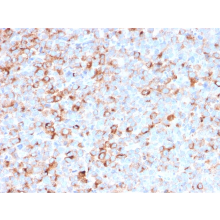 Immunohistochemistry - Anti-Tyrosinase Antibody [T311 + OCA1/812] - BSA and Azide free (A253421) - Antibodies.com