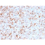 Immunohistochemistry - Anti-Tyrosinase Antibody [T311 + OCA1/812] - BSA and Azide free (A253421) - Antibodies.com