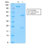 SDS-PAGE - Anti-Tyrosinase Antibody [rOCA1/812] - BSA and Azide free (A253423) - Antibodies.com