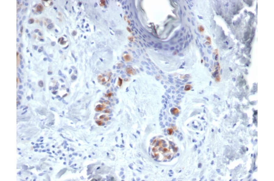 Immunohistochemistry - Anti-Tyrosinase Antibody [TYR/3829] - BSA and Azide free (A253424) - Antibodies.com