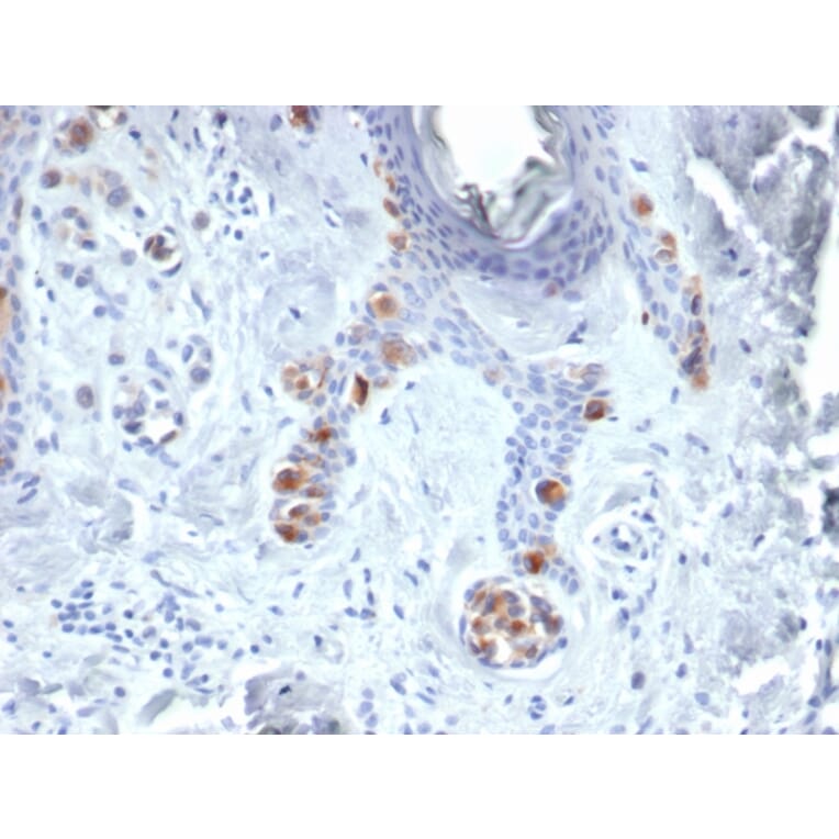 Immunohistochemistry - Anti-Tyrosinase Antibody [TYR/3829] - BSA and Azide free (A253424) - Antibodies.com