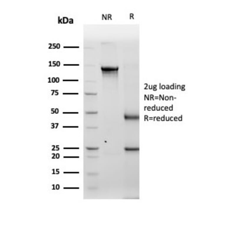 SDS-PAGE - Anti-Tyrosinase Antibody [TYR/3829] - BSA and Azide free (A253424) - Antibodies.com