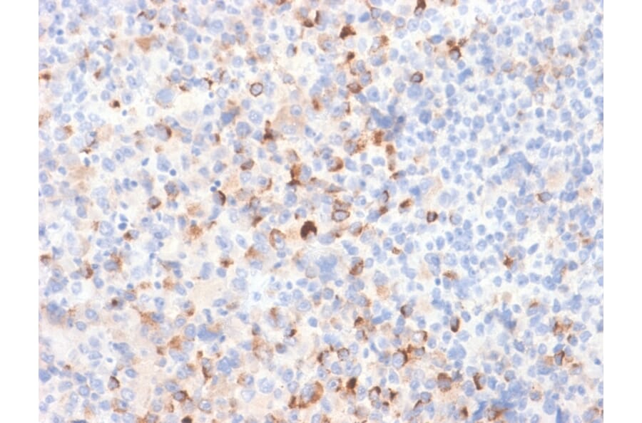 Immunohistochemistry - Anti-Tyrosinase Antibody [TYR/2024R] - BSA and Azide free (A253424) - Antibodies.com