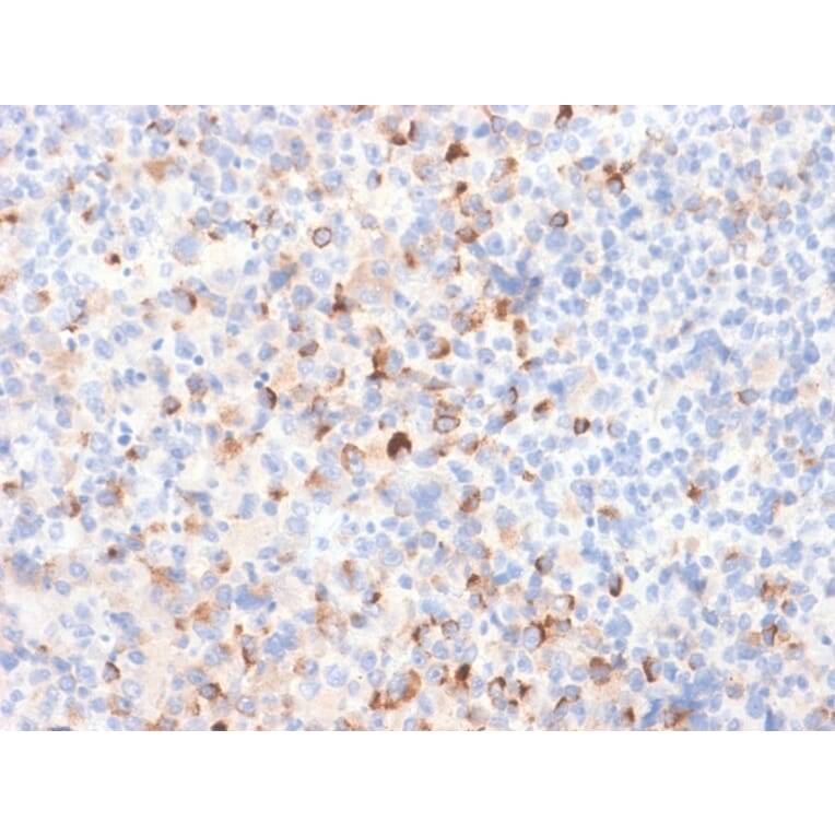 Immunohistochemistry - Anti-Tyrosinase Antibody [TYR/2024R] - BSA and Azide free (A253424) - Antibodies.com