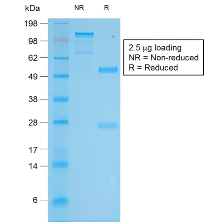 SDS-PAGE - Anti-Tyrosinase Antibody [TYR/2024R] - BSA and Azide free (A253425) - Antibodies.com