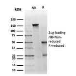 SDS-PAGE - Anti-GTF2H2C Antibody [PCRP-GTF2H2C-2C9] - BSA and Azide free (A253426) - Antibodies.com