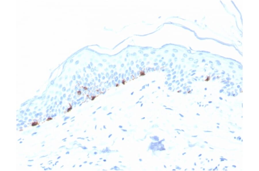 Immunohistochemistry - Anti-TRP1 Antibody [TYRP1/3280] - BSA and Azide free (A253427) - Antibodies.com