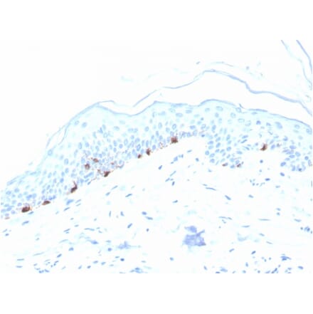 Immunohistochemistry - Anti-TRP1 Antibody [TYRP1/3280] - BSA and Azide free (A253427) - Antibodies.com