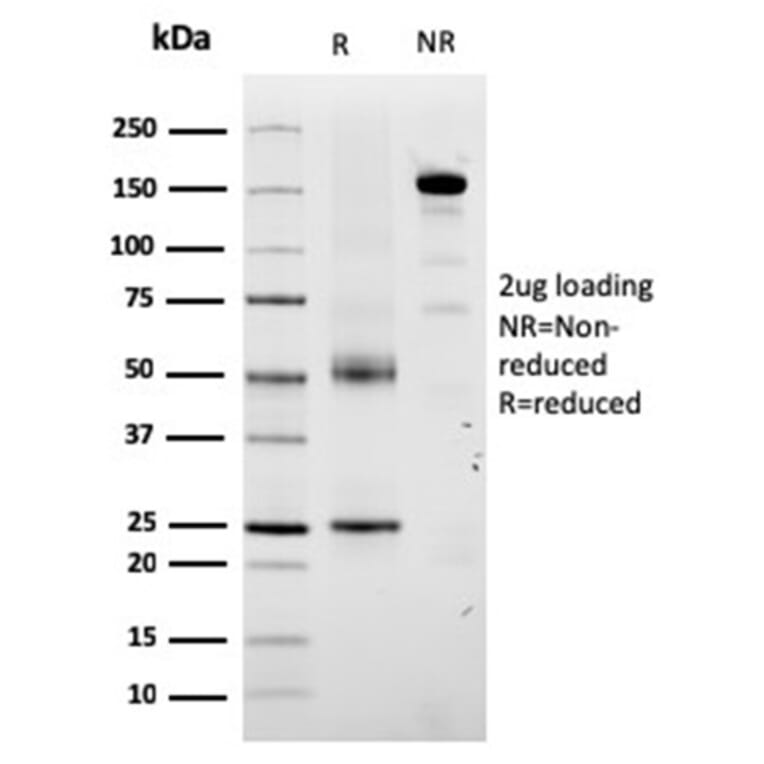 SDS-PAGE - Anti-TRP1 Antibody [TYRP1/3280] - BSA and Azide free (A253427) - Antibodies.com