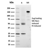 SDS-PAGE - Anti-TRP1 Antibody [TYRP1/3280] - BSA and Azide free (A253427) - Antibodies.com