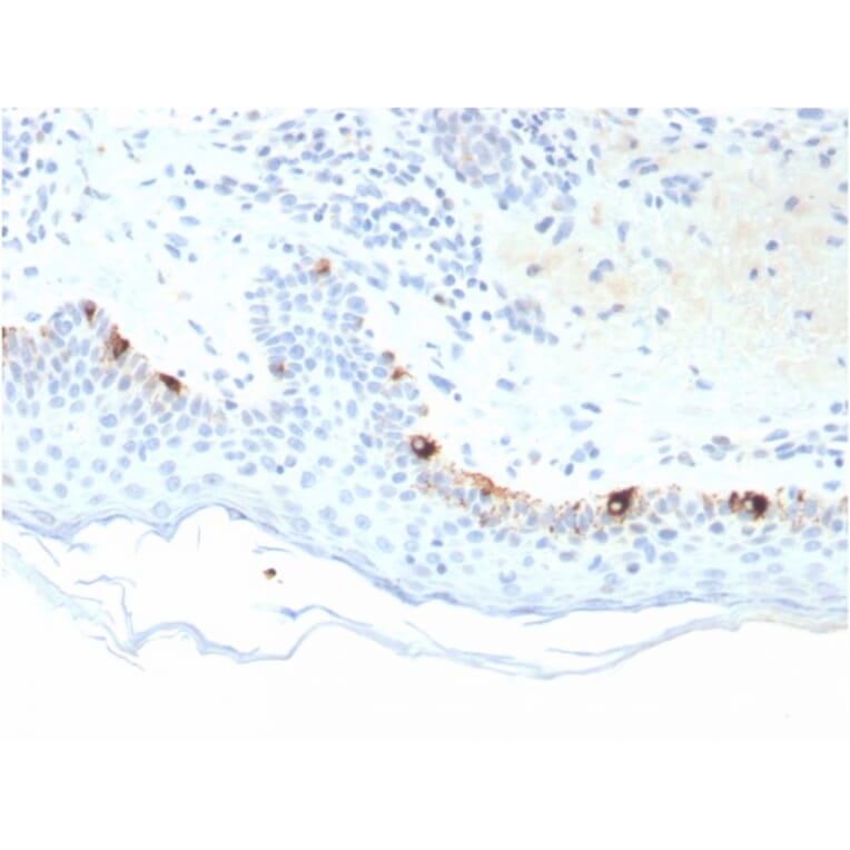 Immunohistochemistry - Anti-TRP1 Antibody [TYRP1/3281] - BSA and Azide free (A253428) - Antibodies.com