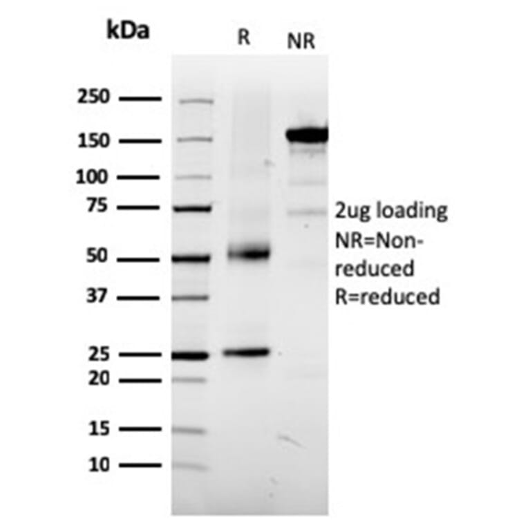 SDS-PAGE - Anti-TRP1 Antibody [TYRP1/3281] - BSA and Azide free (A253428) - Antibodies.com