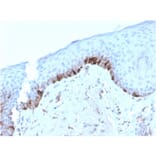 Immunohistochemistry - Anti-TRP1 Antibody [TYRP1/3282] - BSA and Azide free (A253429) - Antibodies.com