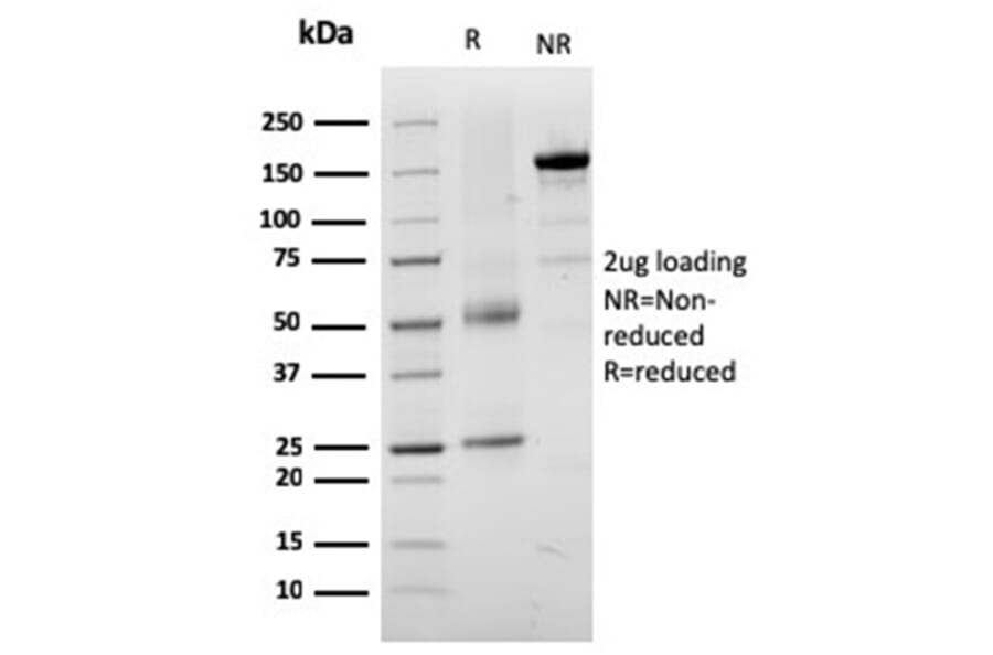 SDS-PAGE - Anti-TRP1 Antibody [TYRP1/3282] - BSA and Azide free (A253429) - Antibodies.com