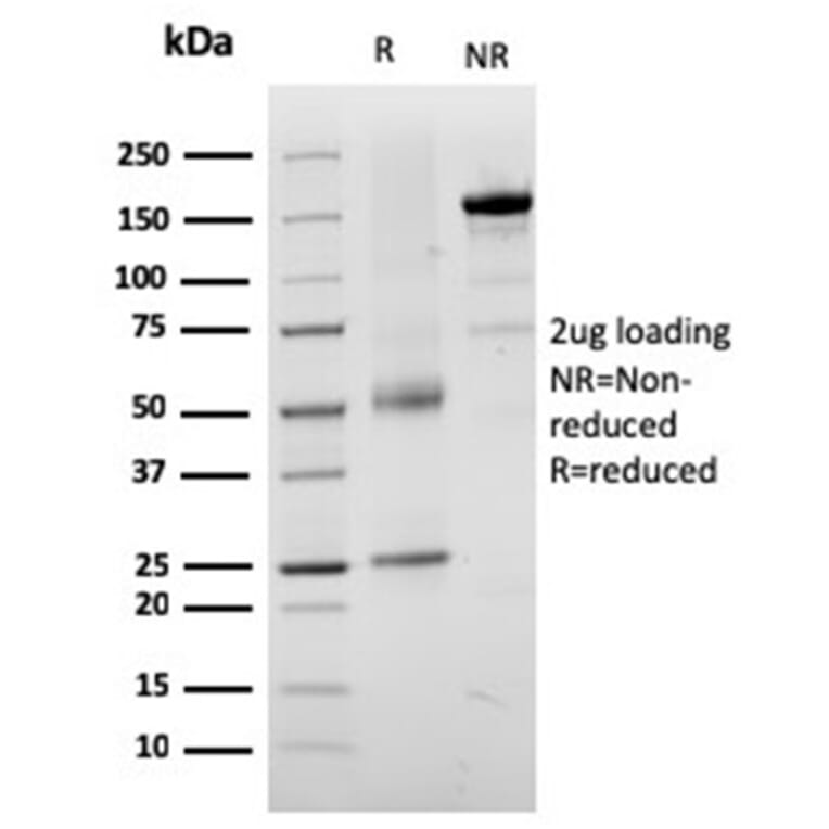 SDS-PAGE - Anti-TRP1 Antibody [TYRP1/3282] - BSA and Azide free (A253429) - Antibodies.com