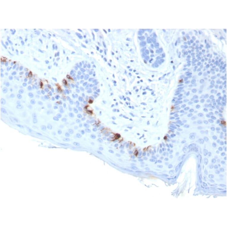 Immunohistochemistry - Anti-TRP1 Antibody [TYRP1/3283] - BSA and Azide free (A253430) - Antibodies.com