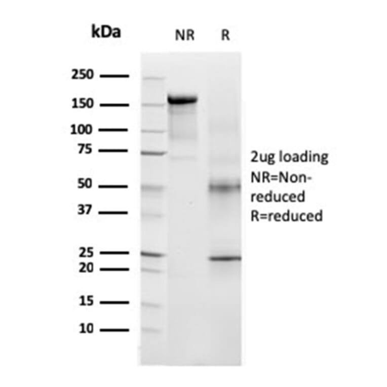 SDS-PAGE - Anti-TRP1 Antibody [TYRP1/3283] - BSA and Azide free (A253430) - Antibodies.com