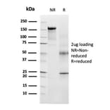 SDS-PAGE - Anti-TRP1 Antibody [TYRP1/3283] - BSA and Azide free (A253430) - Antibodies.com