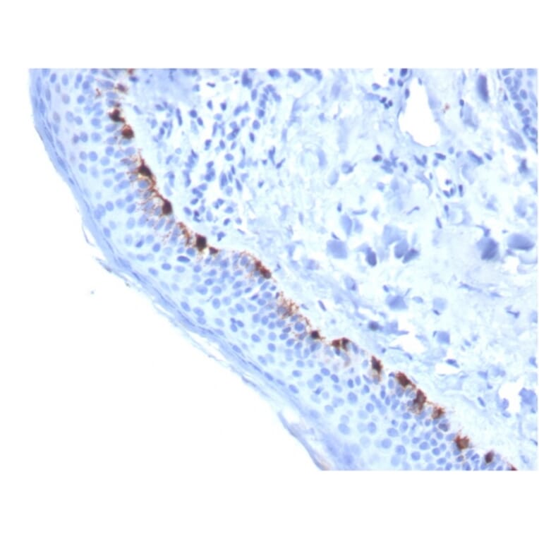 Immunohistochemistry - Anti-TRP1 Antibody [TYRP1/3284] - BSA and Azide free (A253431) - Antibodies.com