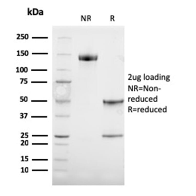 SDS-PAGE - Anti-TRP1 Antibody [TYRP1/3284] - BSA and Azide free (A253431) - Antibodies.com