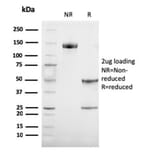 SDS-PAGE - Anti-TRP1 Antibody [TYRP1/3284] - BSA and Azide free (A253431) - Antibodies.com